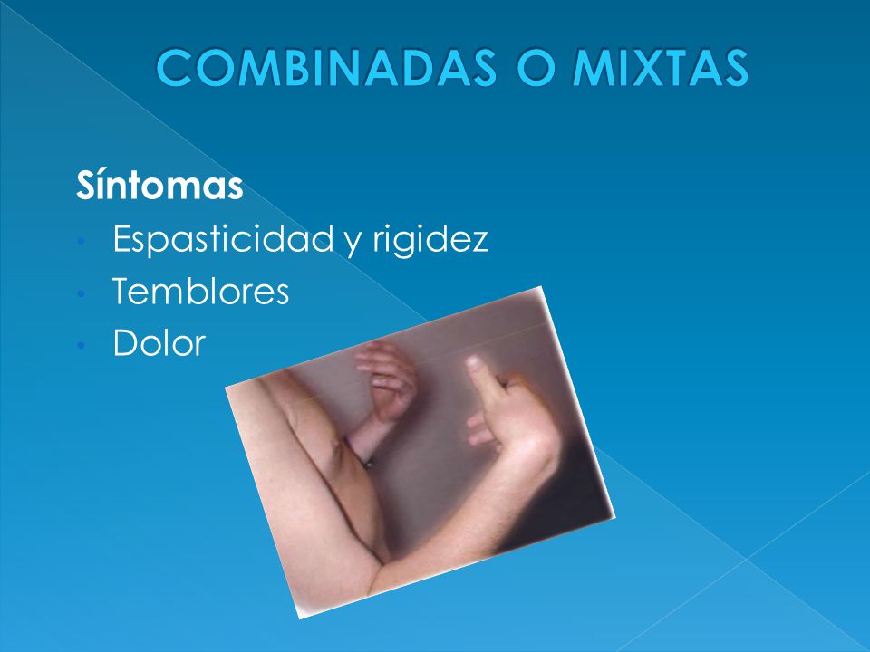 COMBINADAS O MIXTAS Síntomas Espasticidad y rigidez Temblores Dolor