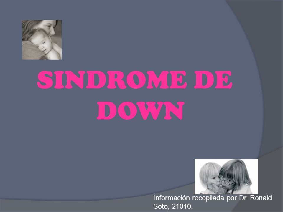 SINDROME DE DOWN Información recopilada por Dr. Ronald Soto,