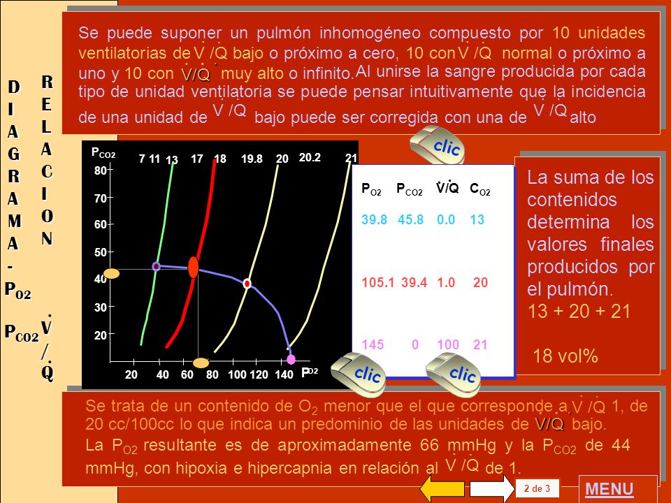 Se puede suponer un pulmón inhomogéneo compuesto por 10 unidades ventilatorias de bajo o próximo a cero, 10 con normal o próximo a uno y 10 con muy alto o infinito.