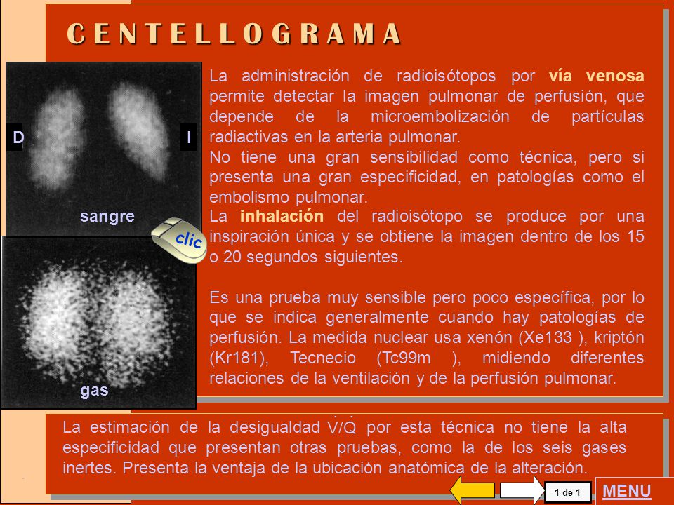 C E N T E L L O G R A M A D. I.