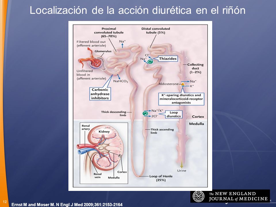 Localización de la acción diurética en el riñón