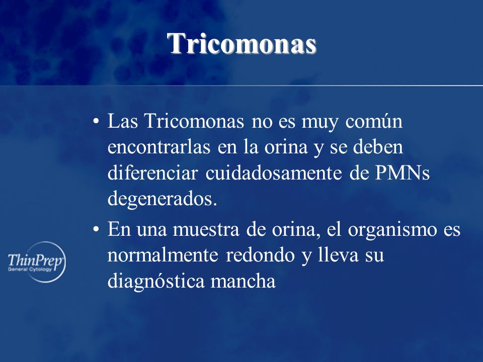 Tricomonas Las Tricomonas no es muy común encontrarlas en la orina y se deben diferenciar cuidadosamente de PMNs degenerados.