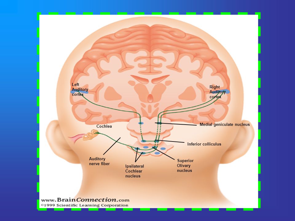 Left Auditory. cortex. Right. Auditory. cortex. Medial geniculate nucleus. Cochlea. Inferior colliculus.