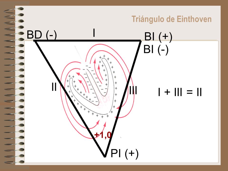 I BD (-) BI (+) BI (-) II III I + III = II PI (+)