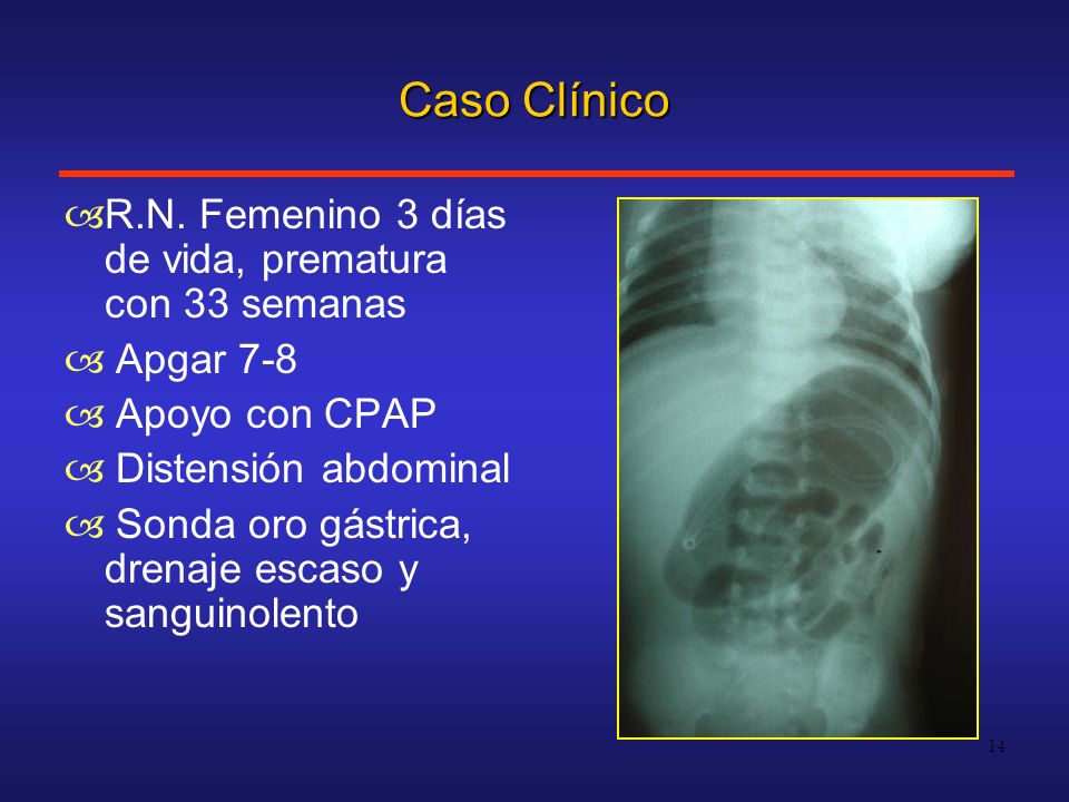 Caso Clínico R.N. Femenino 3 días de vida, prematura con 33 semanas