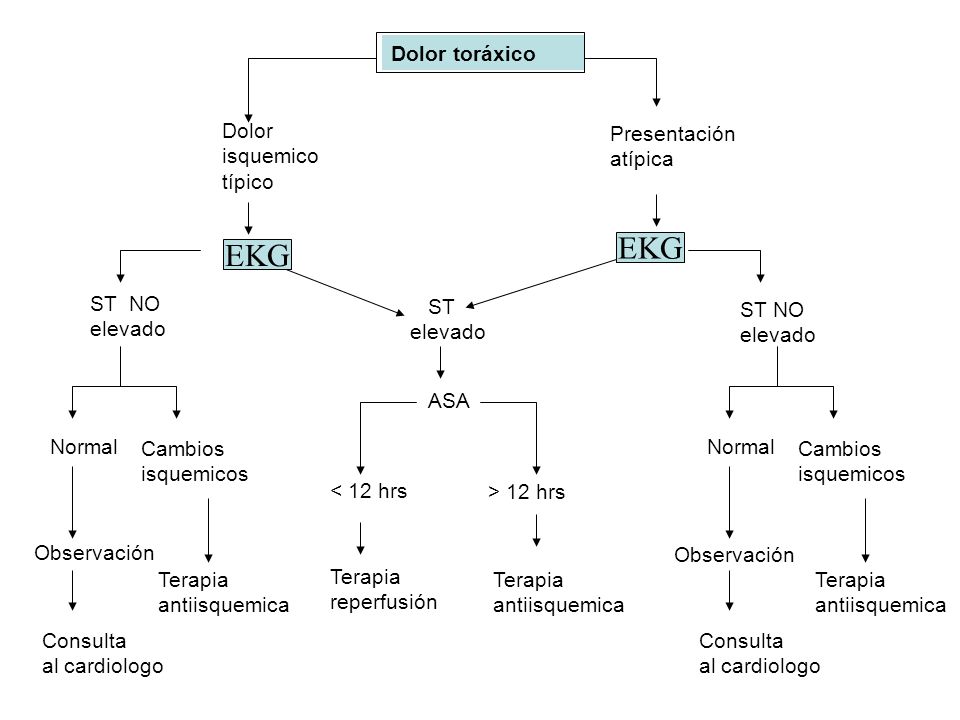 EKG EKG Dolor toráxico Dolor isquemico típico Presentación atípica EKG