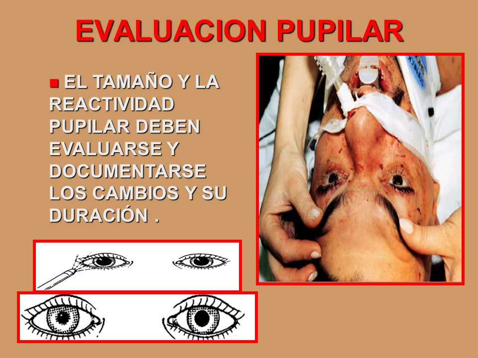 EVALUACION PUPILAR EL TAMAÑO Y LA REACTIVIDAD PUPILAR DEBEN EVALUARSE Y DOCUMENTARSE LOS CAMBIOS Y SU DURACIÓN .