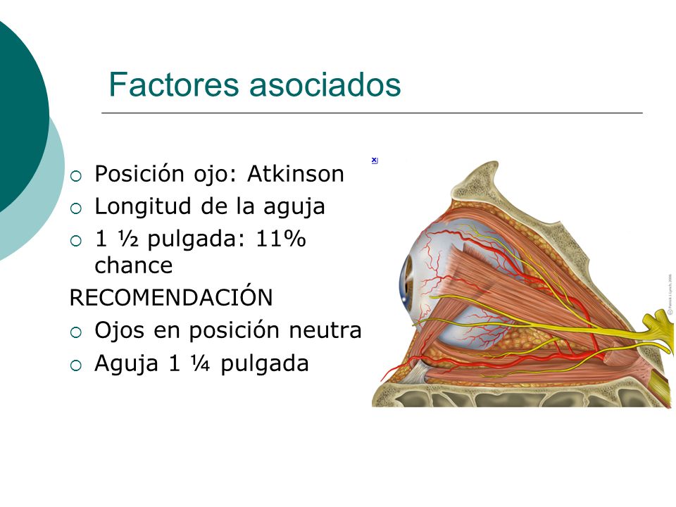 Factores asociados Posición ojo: Atkinson Longitud de la aguja