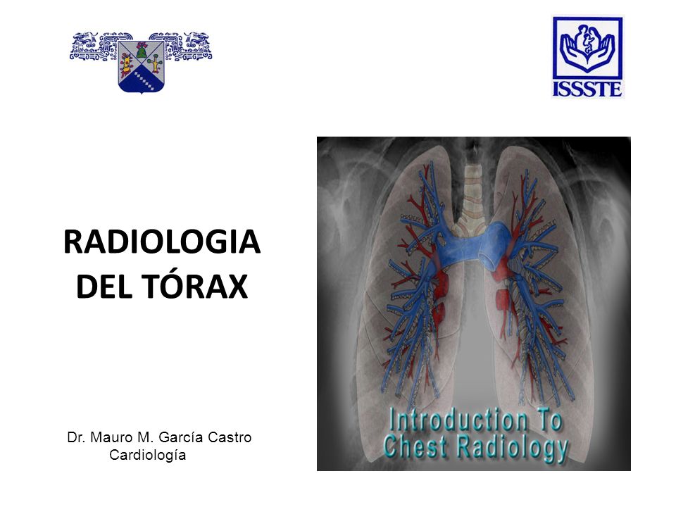RADIOLOGIA DEL TÓRAX Dr. Mauro M. García Castro Cardiología