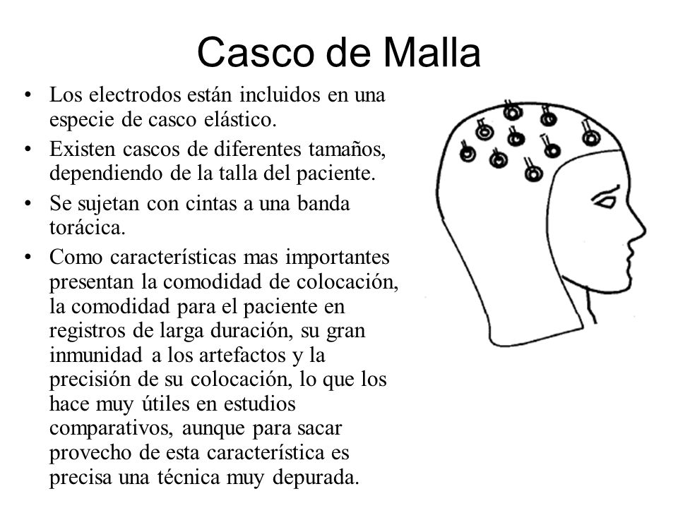 Casco de Malla Los electrodos están incluidos en una especie de casco elástico.