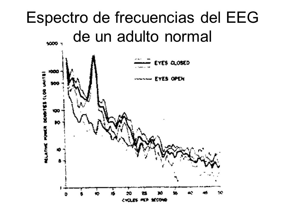 Espectro de frecuencias del EEG de un adulto normal