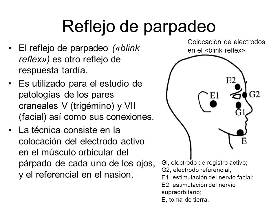 Reflejo de parpadeo Colocación de electrodos en el «blink reflex» El reflejo de parpadeo («blink reflex») es otro reflejo de respuesta tardía.