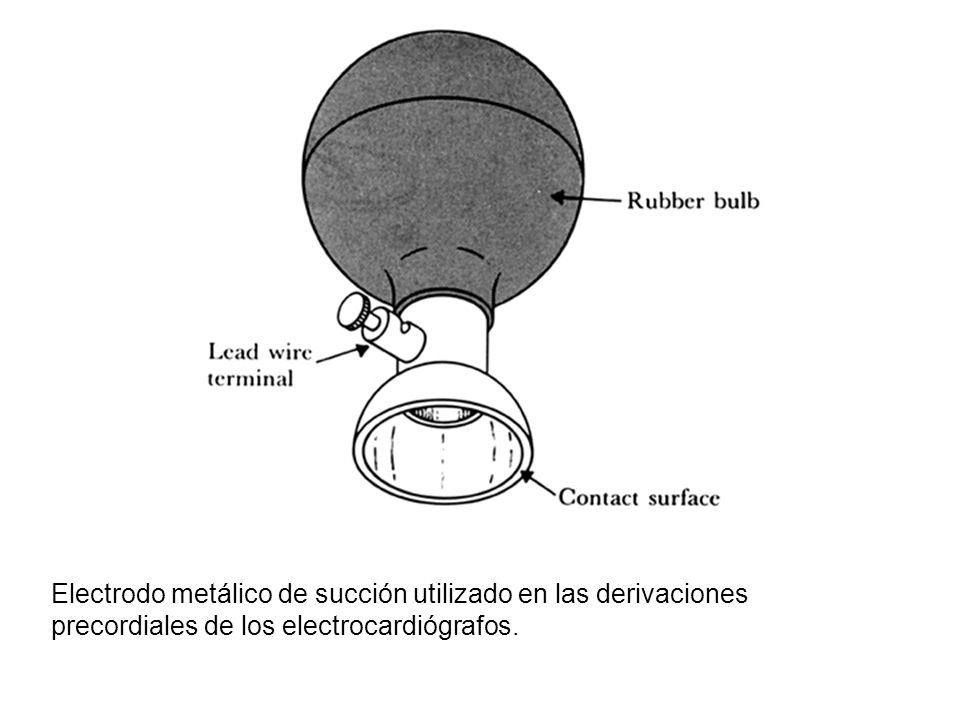 Electrodo metálico de succión utilizado en las derivaciones precordiales de los electrocardiógrafos.
