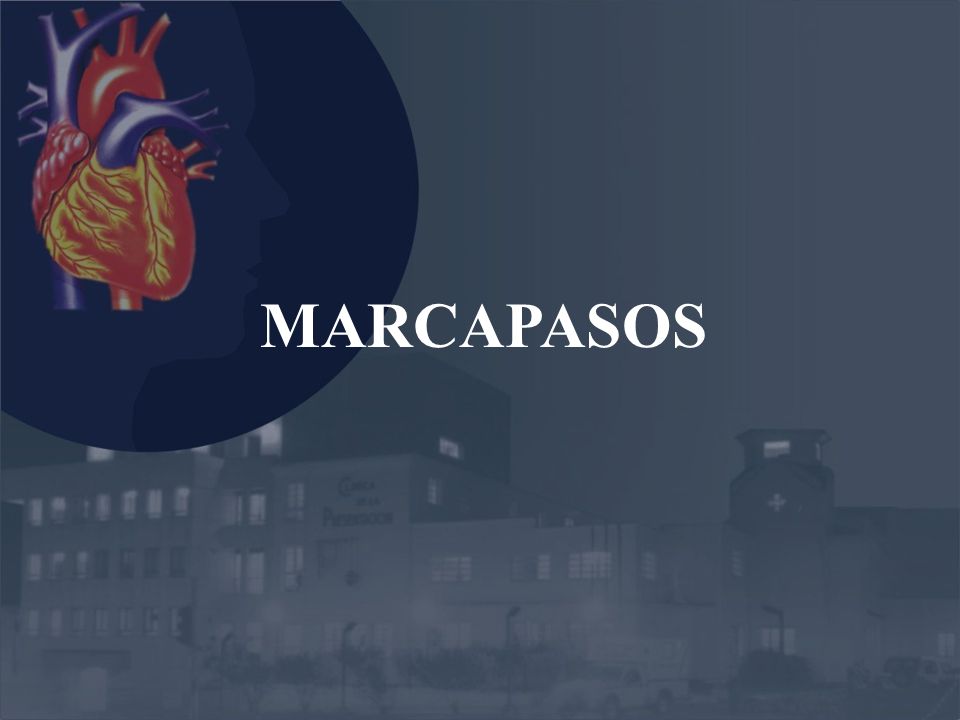 MARCAPASOS