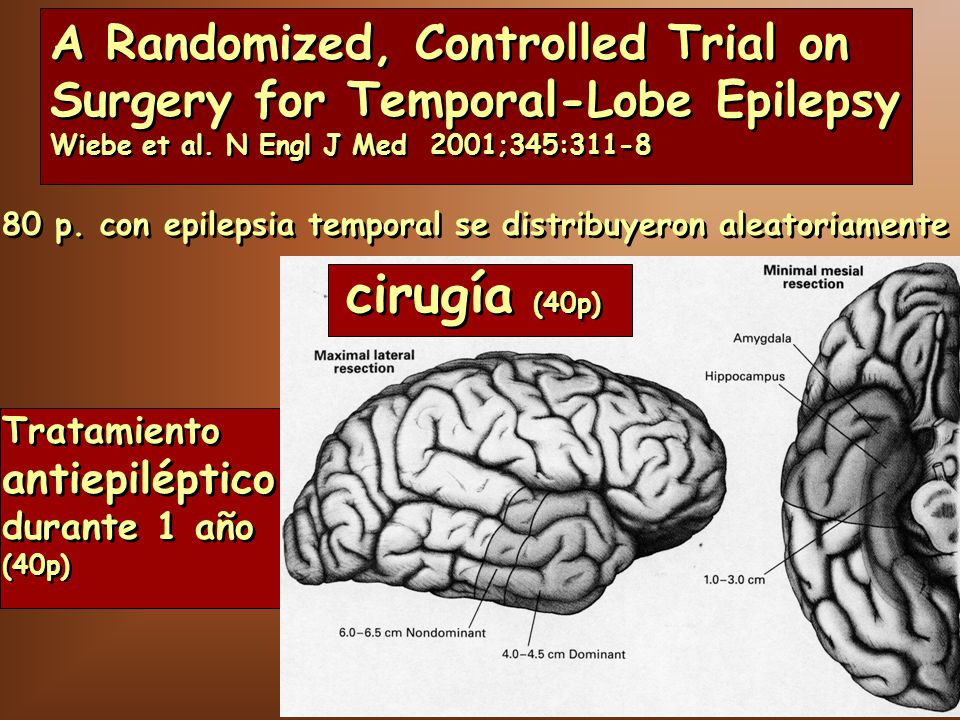A Randomized, Controlled Trial on Surgery for Temporal-Lobe Epilepsy Wiebe et al. N Engl J Med 2001;345:311-8