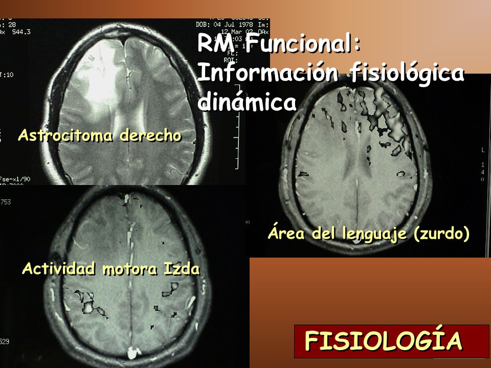 RM Funcional: Información fisiológica dinámica