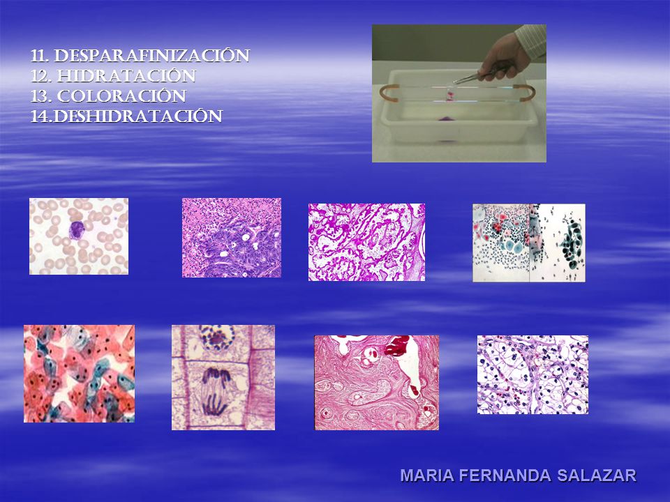 11. DESPARAFINIZACIÓN 12. HIDRATACIÓN 13. Coloración 14.DESHIDRATACIÓN MARIA FERNANDA SALAZAR