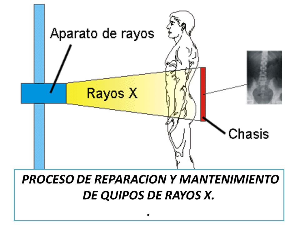 PROCESO DE REPARACION Y MANTENIMIENTO DE QUIPOS DE RAYOS X.