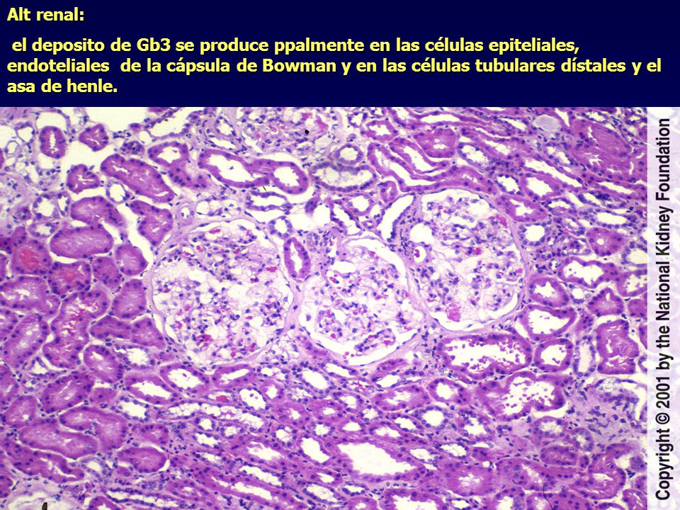 Alt renal: