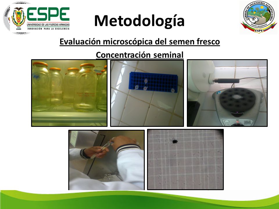 Evaluación microscópica del semen fresco Concentración seminal