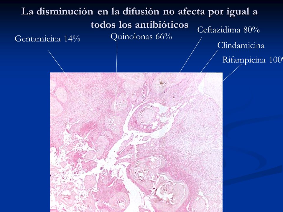 La disminución en la difusión no afecta por igual a todos los antibióticos