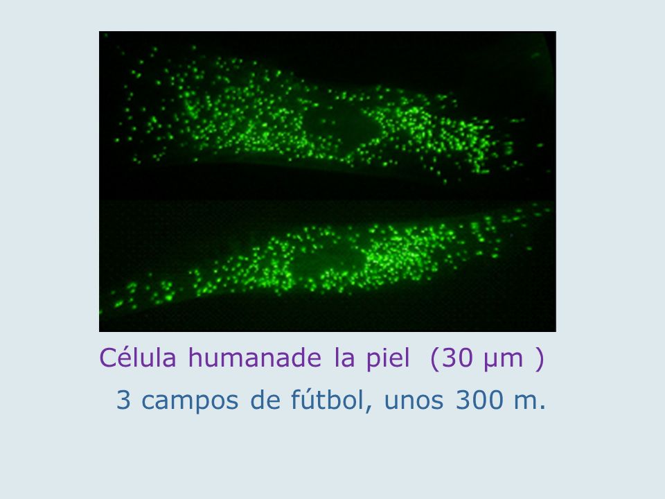 Célula humanade la piel (30 µm )