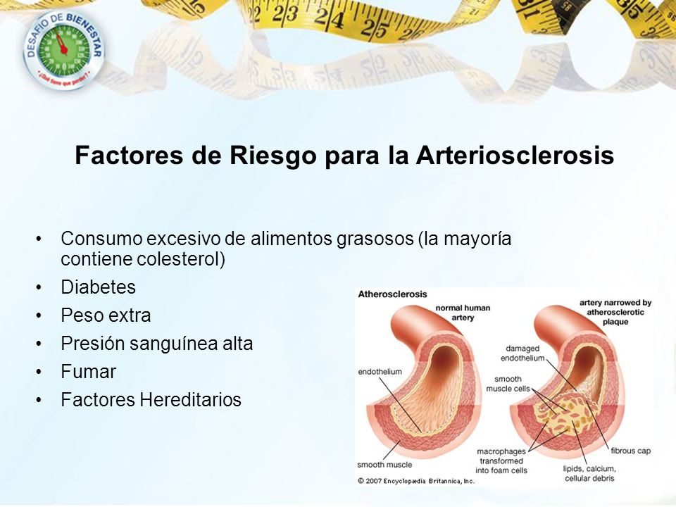 Factores de Riesgo para la Arteriosclerosis