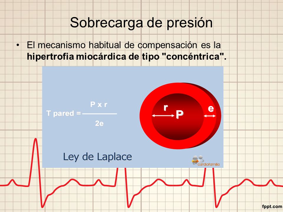 Sobrecarga de presión El mecanismo habitual de compensación es la hipertrofia miocárdica de tipo concéntrica .