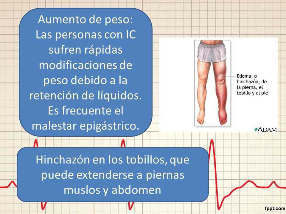 Aumento de peso: Las personas con IC sufren rápidas modificaciones de peso debido a la retención de líquidos. Es frecuente el malestar epigástrico.