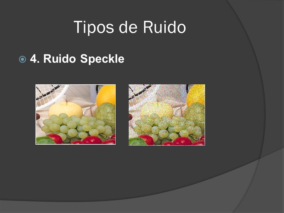 Tipos de Ruido 4. Ruido Speckle