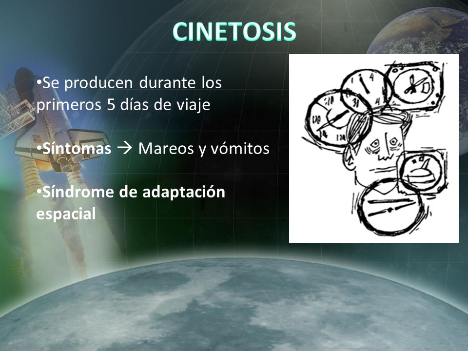 CINETOSIS Se producen durante los primeros 5 días de viaje