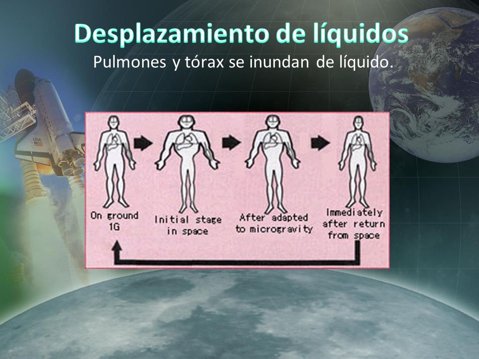 Desplazamiento de líquidos Pulmones y tórax se inundan de líquido.