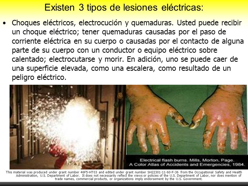 Existen 3 tipos de lesiones eléctricas: