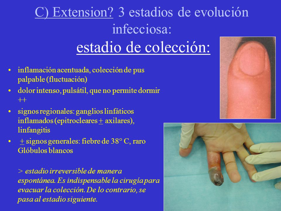 C) Extension 3 estadios de evolución infecciosa: estadio de colección: