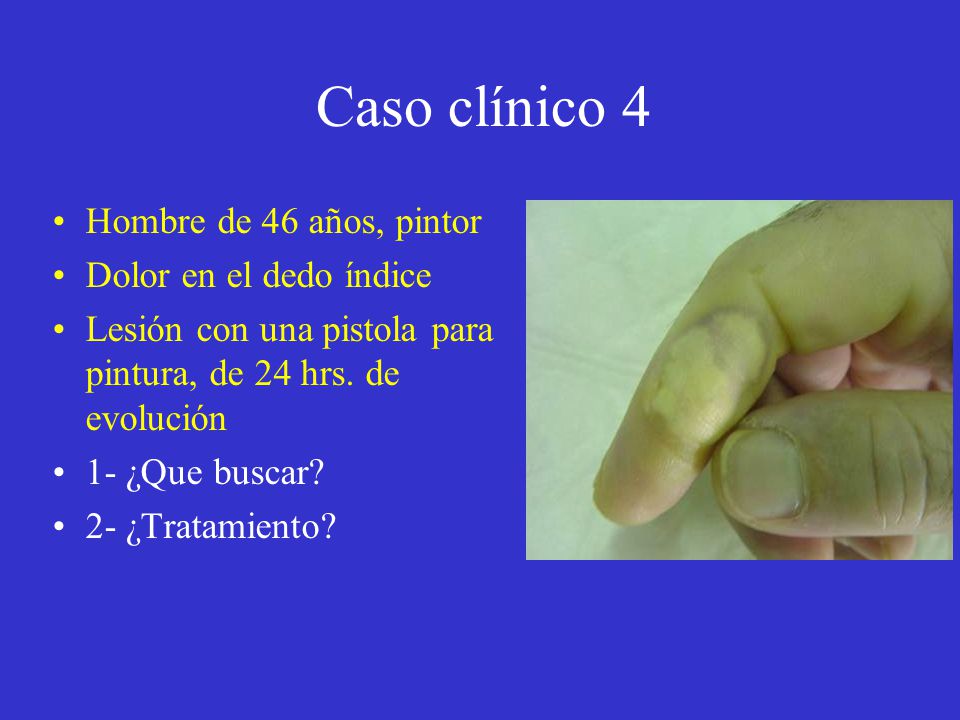 Caso clínico 4 Hombre de 46 años, pintor Dolor en el dedo índice