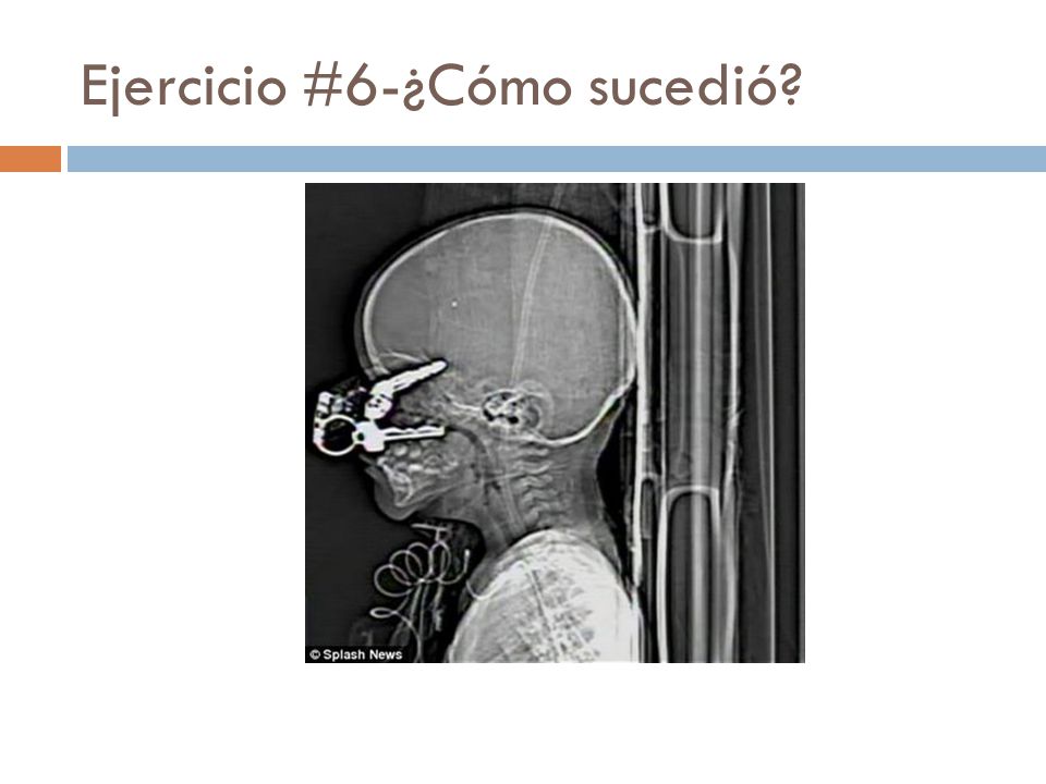 Ejercicio #6-¿Cómo sucedió