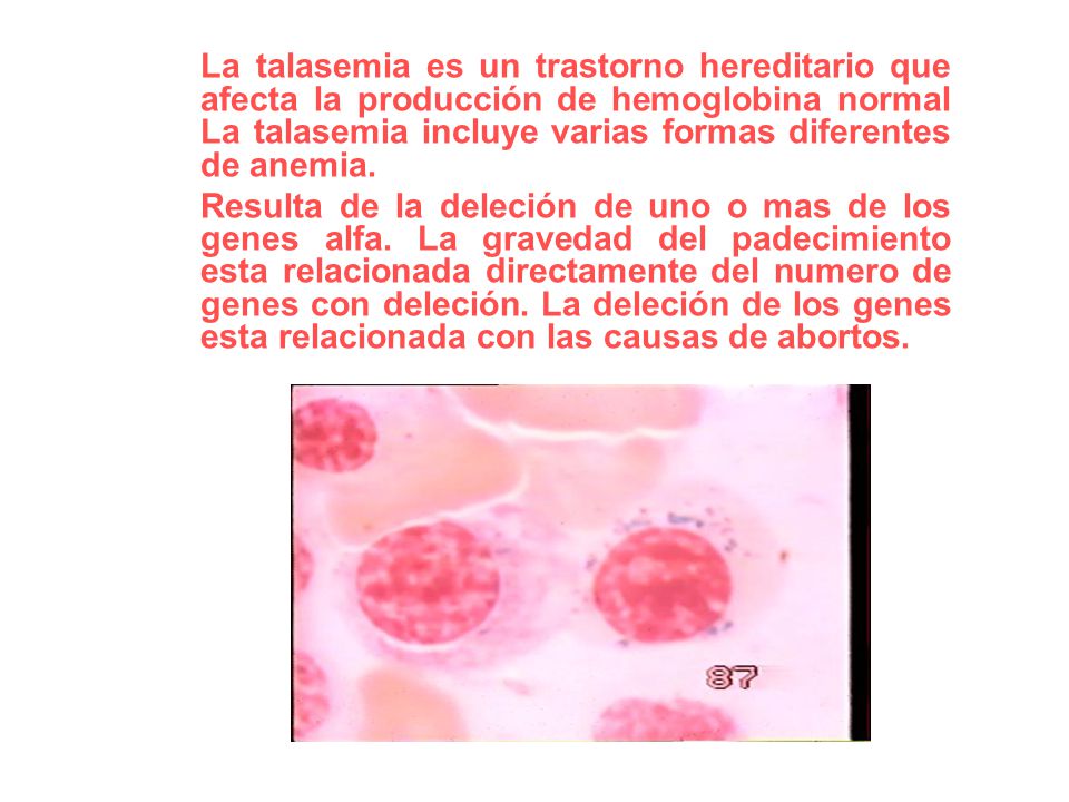 La talasemia es un trastorno hereditario que afecta la producción de hemoglobina normal La talasemia incluye varias formas diferentes de anemia.