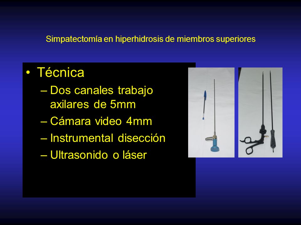 Simpatectomía en hiperhidrosis de miembros superiores