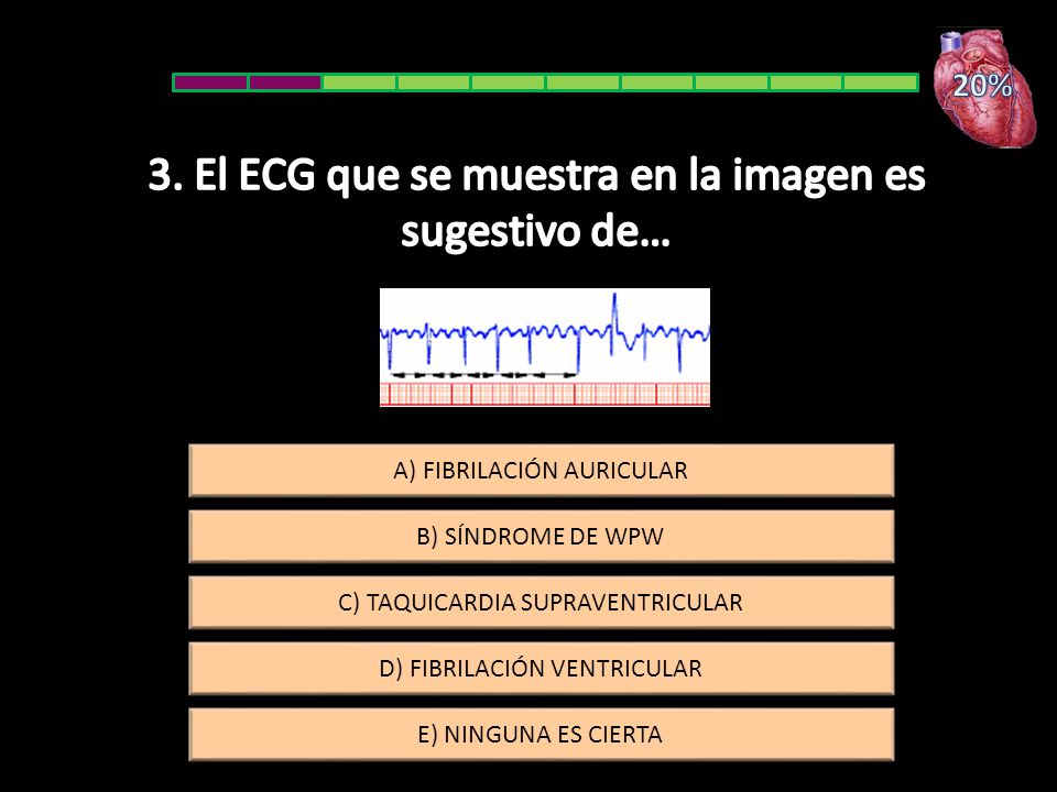 3. El ECG que se muestra en la imagen es sugestivo de…