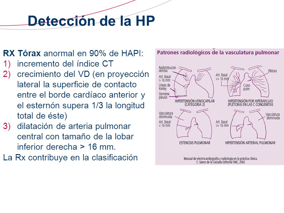 Detección de la HP RX Tórax anormal en 90% de HAPI: