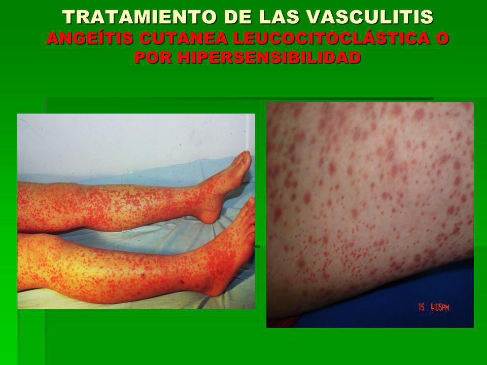 TRATAMIENTO DE LAS VASCULITIS ANGEÍTIS CUTANEA LEUCOCITOCLÁSTICA O POR HIPERSENSIBILIDAD