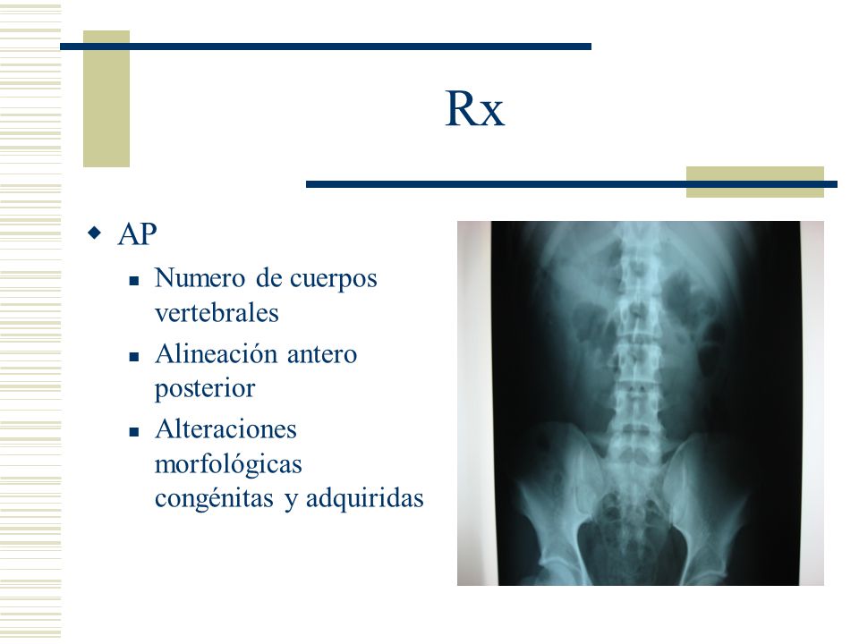 Rx AP Numero de cuerpos vertebrales Alineación antero posterior