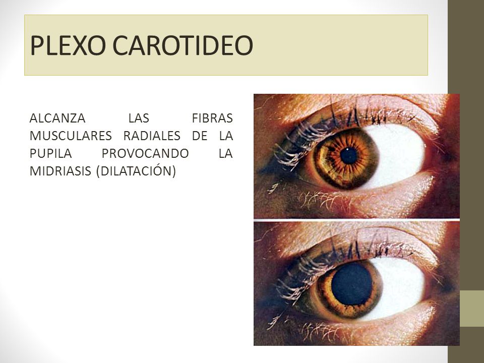 PLEXO CAROTIDEO ALCANZA LAS FIBRAS MUSCULARES RADIALES DE LA PUPILA PROVOCANDO LA MIDRIASIS (DILATACIÓN)
