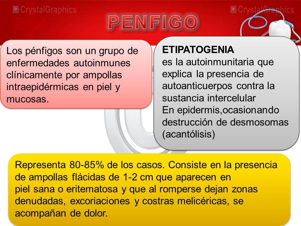 PENFIGO ETIPATOGENIA. es la autoinmunitaria que explica la presencia de autoanticuerpos contra la sustancia intercelular.