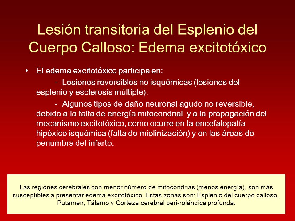 Lesión transitoria del Esplenio del Cuerpo Calloso: Edema excitotóxico