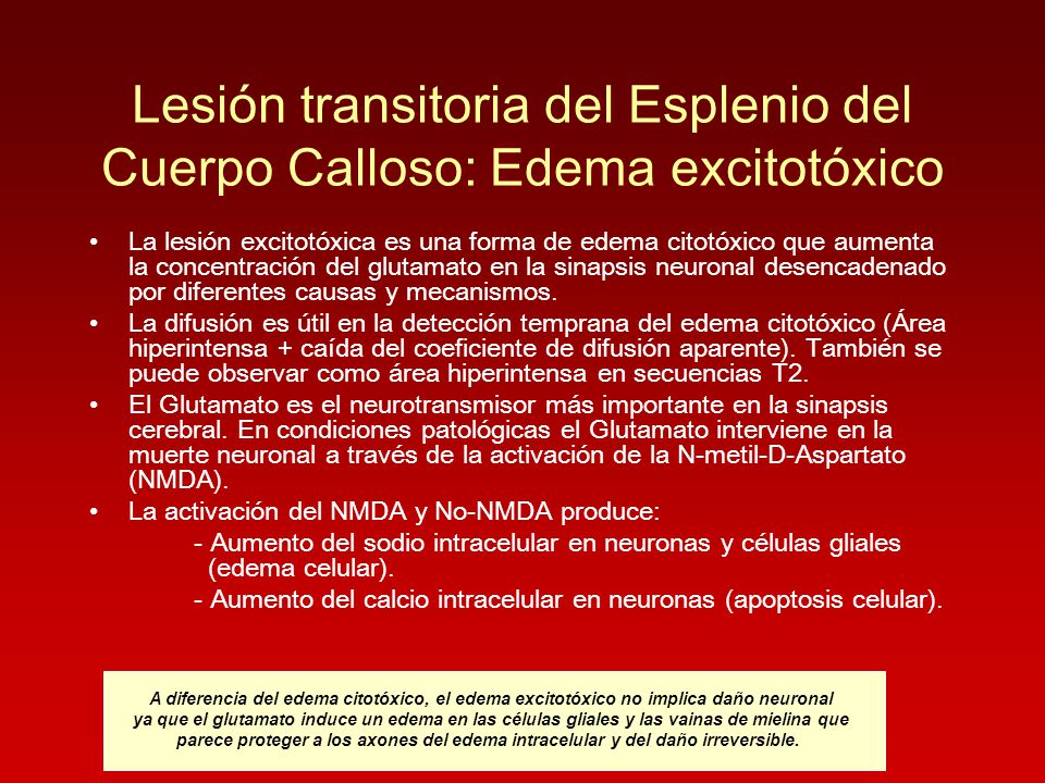 Lesión transitoria del Esplenio del Cuerpo Calloso: Edema excitotóxico