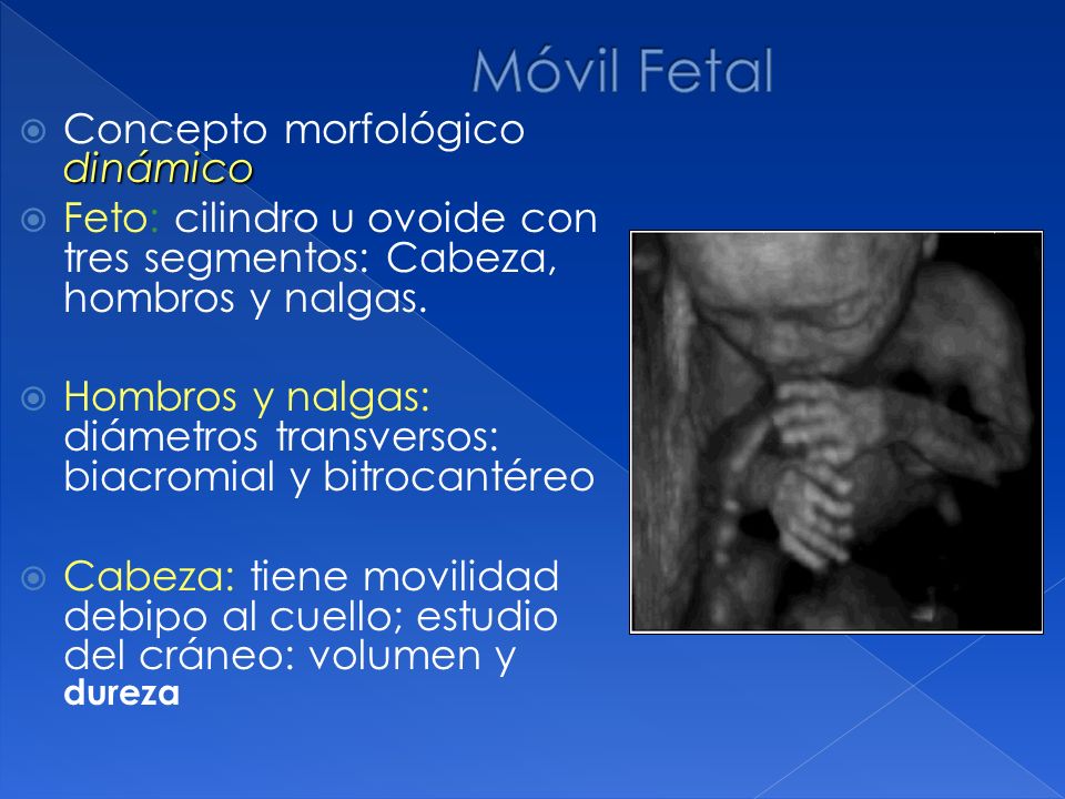 Móvil Fetal Concepto morfológico dinámico