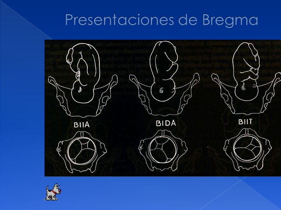 Presentaciones de Bregma