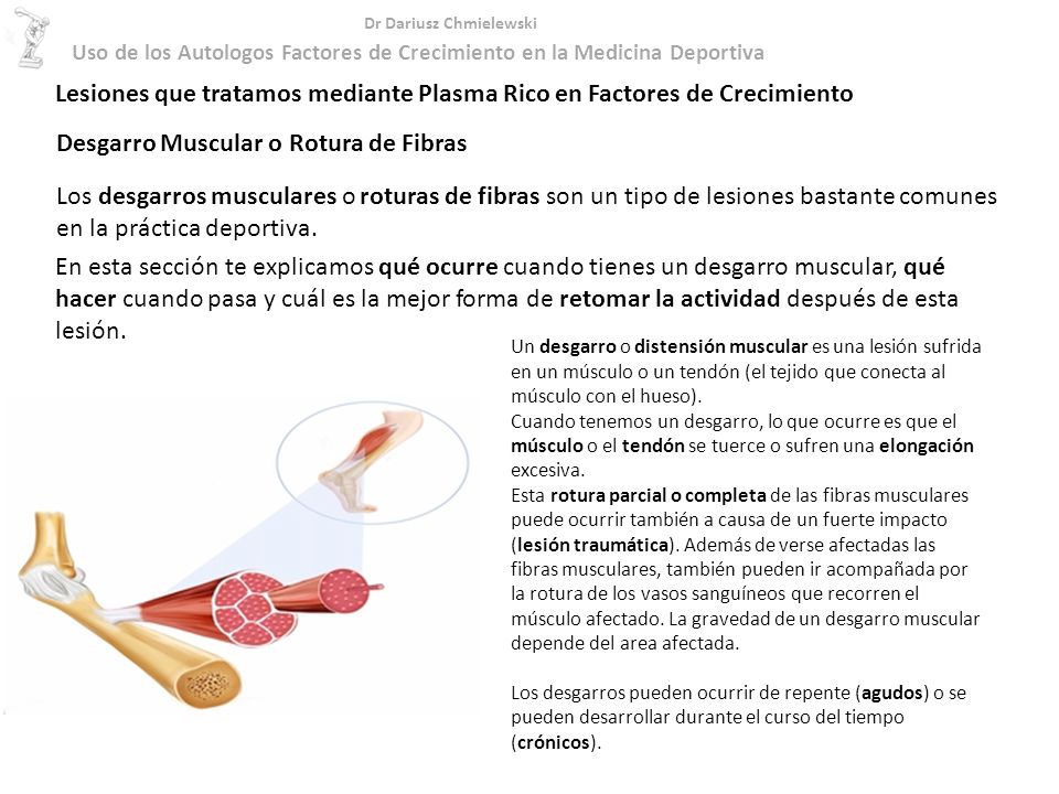 Lesiones que tratamos mediante Plasma Rico en Factores de Crecimiento