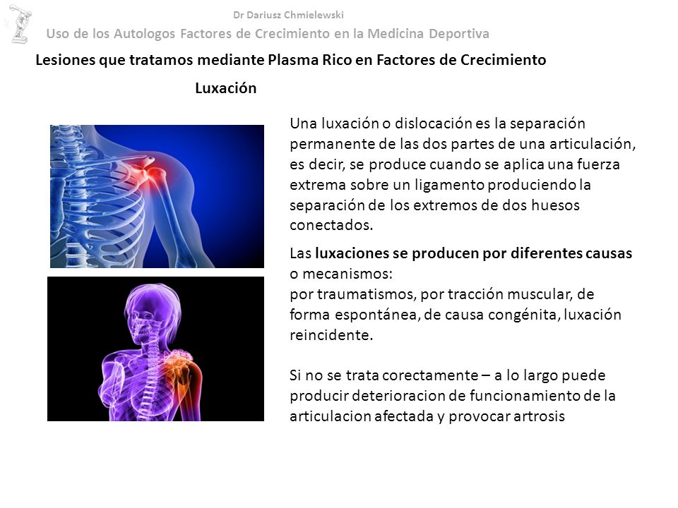 Lesiones que tratamos mediante Plasma Rico en Factores de Crecimiento